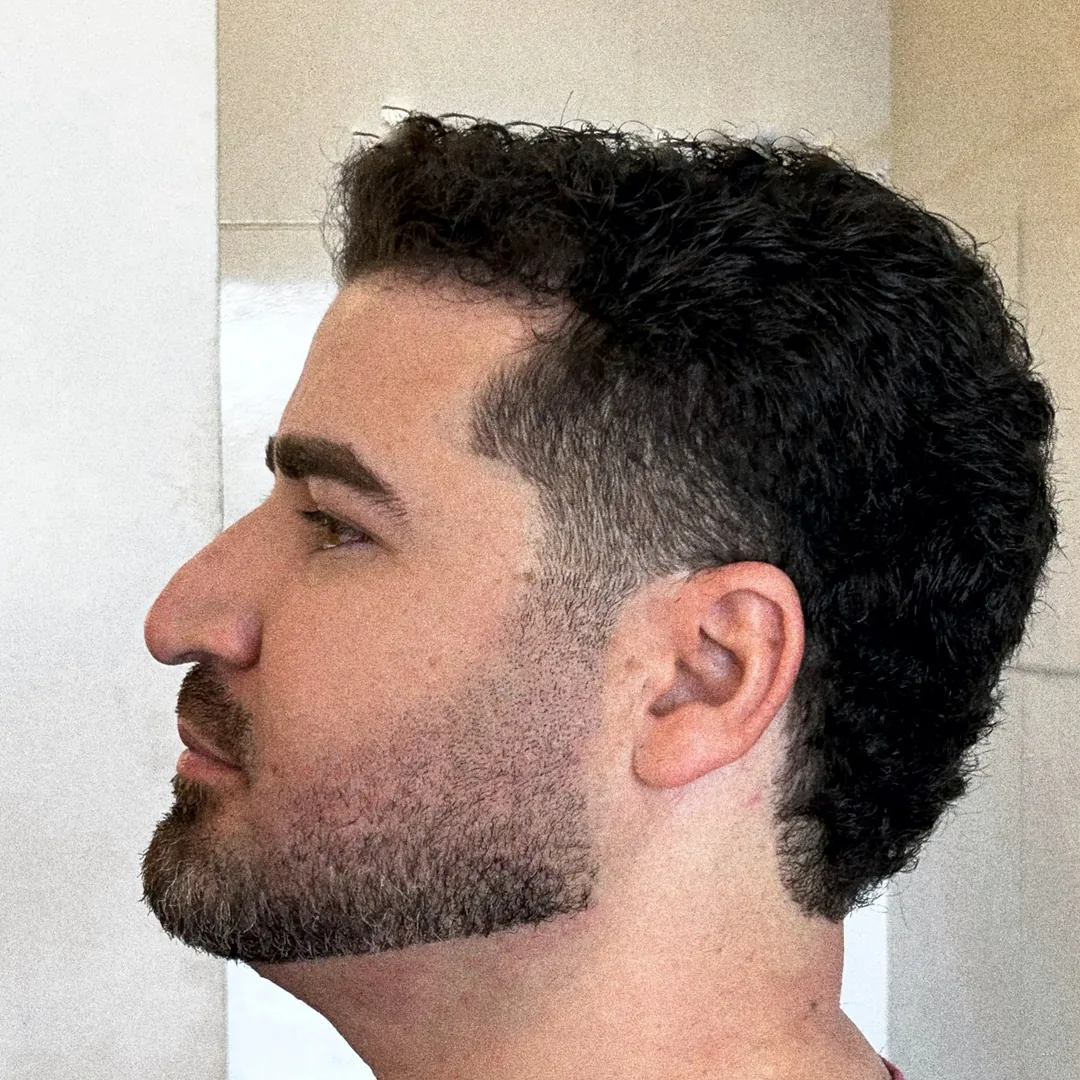 Depois: mesmo cliente com barba desenhada e cabelo com volume direcionado